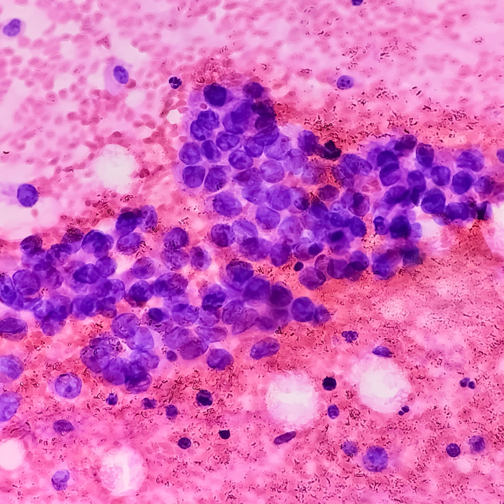 A cell viewed through a microscope.