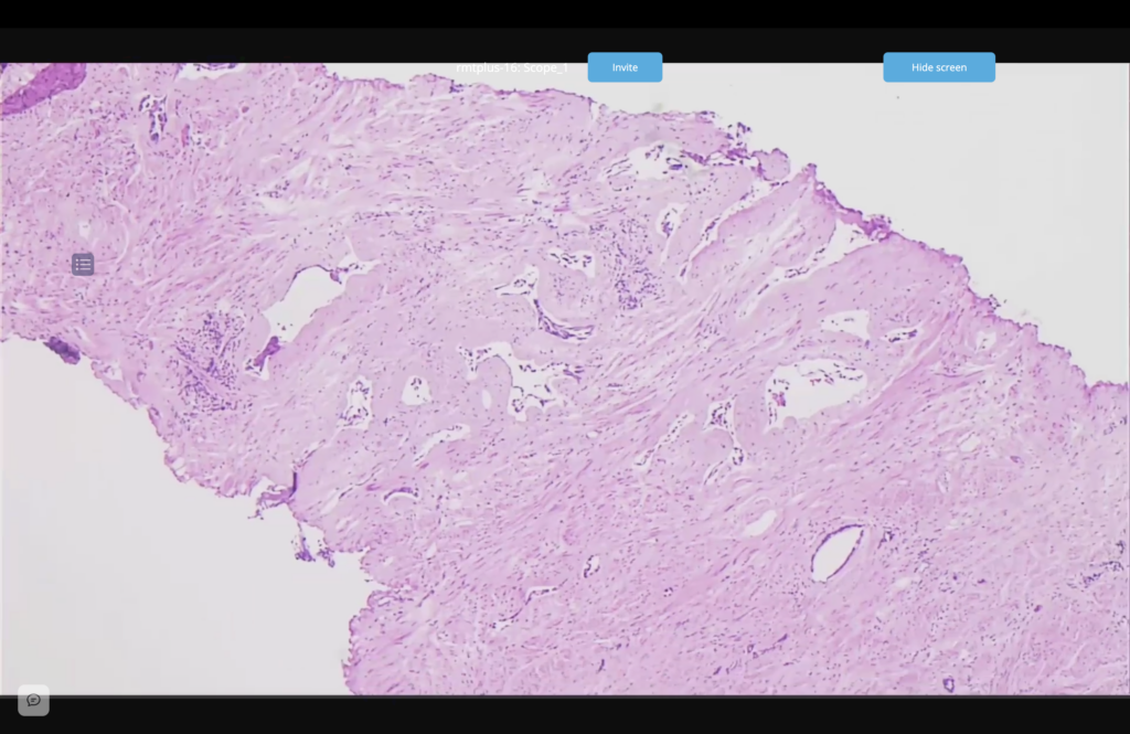 How-it-Works-Technology-Streamlined-Workflow-Setup-to-Decision