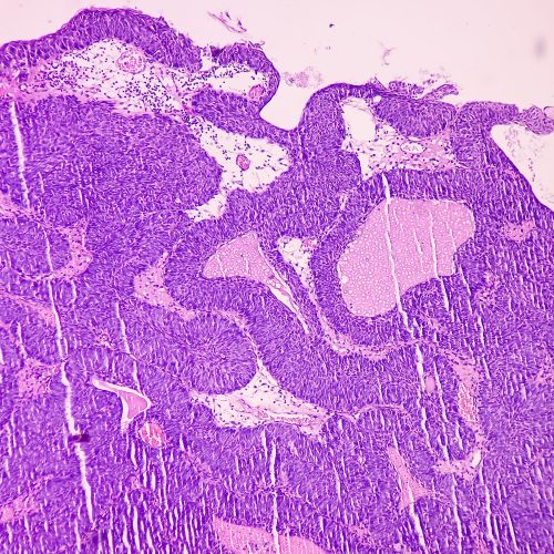 Homepage-cell-Revolutionizing-Healthcare-2400x2263